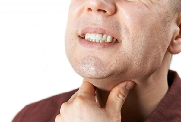 Đau rát họng là triệu chứng điển hình của loét miệng họng